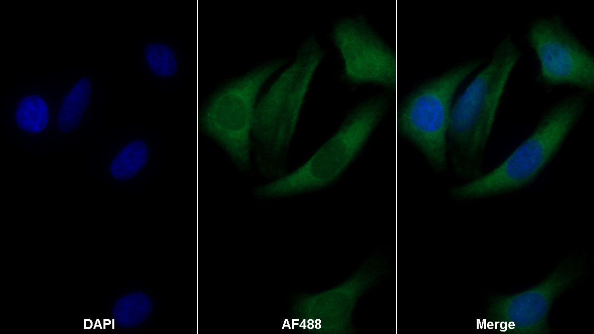 Monoclonal Antibody to Periostin (POSTN)