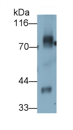 Monoclonal Antibody to Periostin (POSTN)