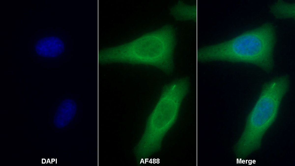 Monoclonal Antibody to Plastin 3 (PLS3)