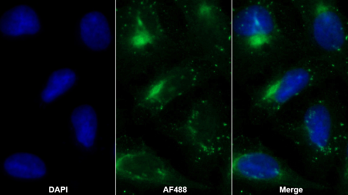 Monoclonal Antibody to Nexilin (NEXN)