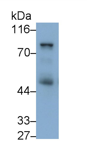 Monoclonal Antibody to Nexilin (NEXN)