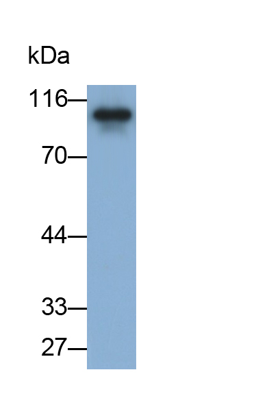 Monoclonal Antibody to Nexilin (NEXN)