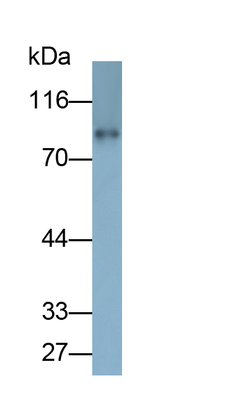 Monoclonal Antibody to Nexilin (NEXN)