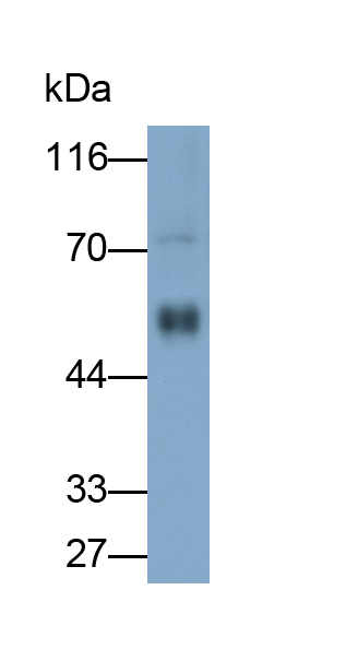 Monoclonal Antibody to Mesothelin (MSLN)