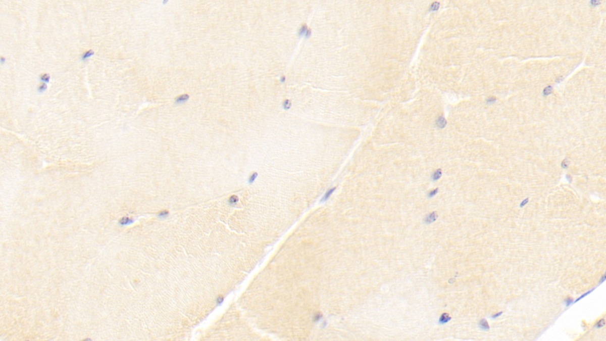 Monoclonal Antibody to Immunoglobulin Superfamily Containing Leucine Rich Repeat Protein (ISLR)