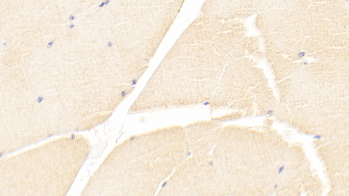 Monoclonal Antibody to Immunoglobulin Superfamily Containing Leucine Rich Repeat Protein (ISLR)