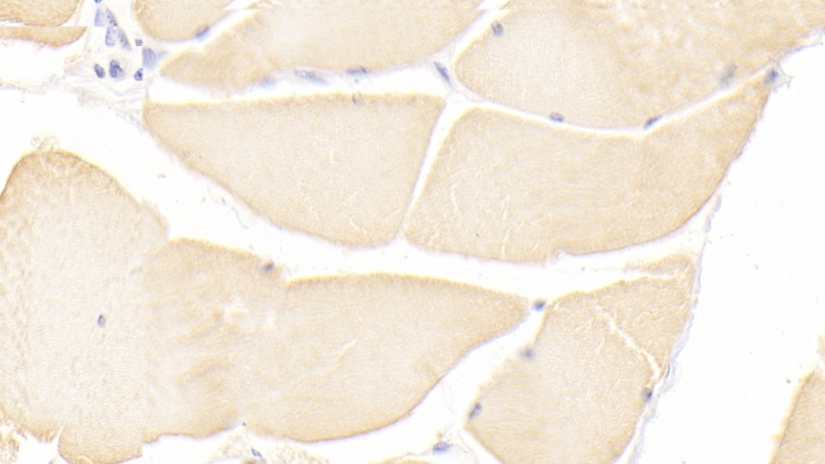 Monoclonal Antibody to Immunoglobulin Superfamily Containing Leucine Rich Repeat Protein (ISLR)