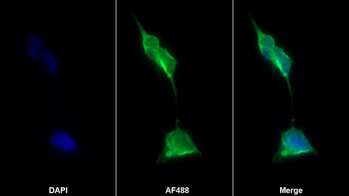 Monoclonal Antibody to Immunoglobulin Superfamily Containing Leucine Rich Repeat Protein (ISLR)