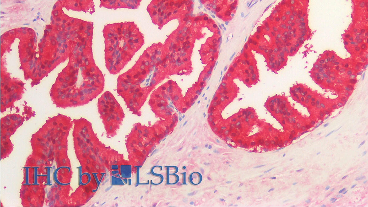 Monoclonal Antibody to Isocitrate Dehydrogenase 1, Soluble (IDH1)