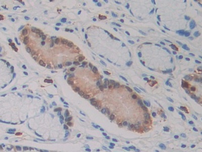 Monoclonal Antibody to Isocitrate Dehydrogenase 1, Soluble (IDH1)