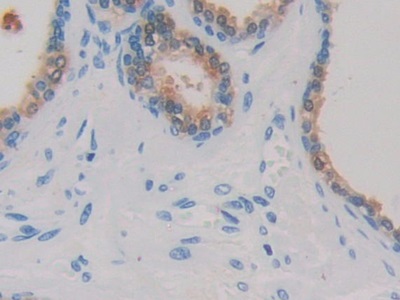 Monoclonal Antibody to Isocitrate Dehydrogenase 1, Soluble (IDH1)