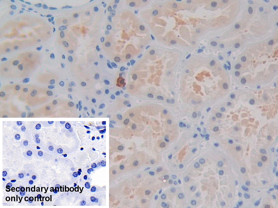 Monoclonal Antibody to Isocitrate Dehydrogenase 1, Soluble (IDH1)