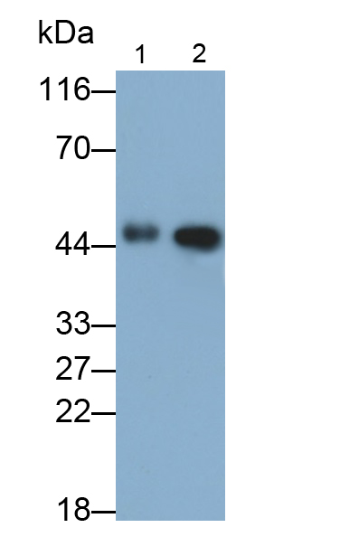 Monoclonal Antibody to Isocitrate Dehydrogenase 1, Soluble (IDH1)