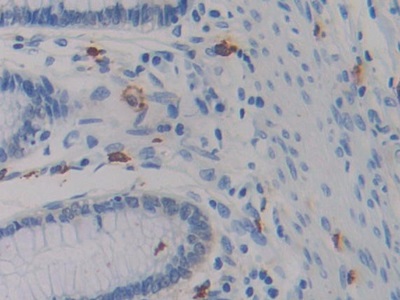 Monoclonal Antibody to Isocitrate Dehydrogenase 1, Soluble (IDH1)