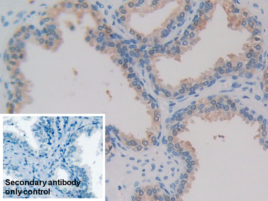 Monoclonal Antibody to Isocitrate Dehydrogenase 1, Soluble (IDH1)