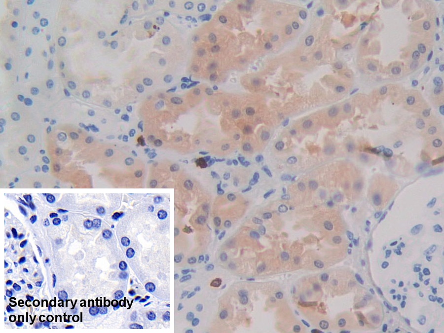 Monoclonal Antibody to Isocitrate Dehydrogenase 1, Soluble (IDH1)