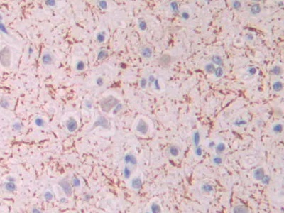 Monoclonal Antibody to Isocitrate Dehydrogenase 1, Soluble (IDH1)