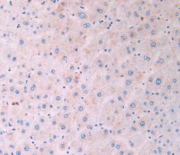 Monoclonal Antibody to Isocitrate Dehydrogenase 1, Soluble (IDH1)