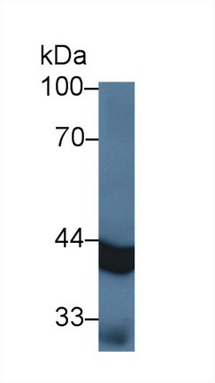 Monoclonal Antibody to Isocitrate Dehydrogenase 1, Soluble (IDH1)