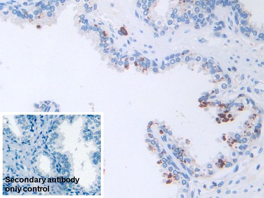 Monoclonal Antibody to Isocitrate Dehydrogenase 1, Soluble (IDH1)