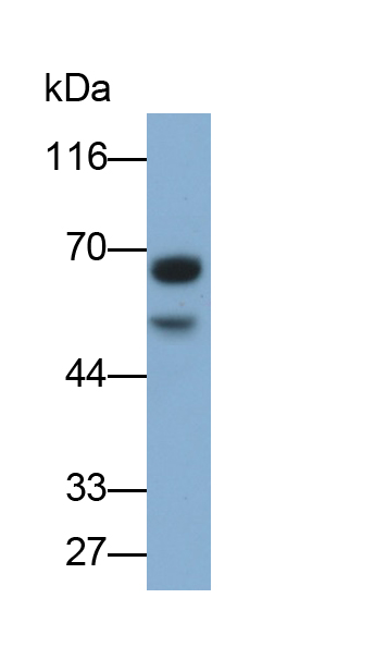 Monoclonal Antibody to Hornerin (HRNR)