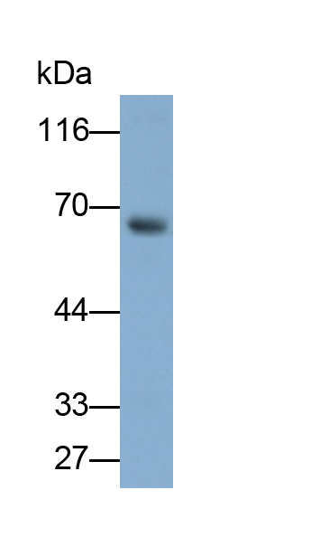 Monoclonal Antibody to Hornerin (HRNR)