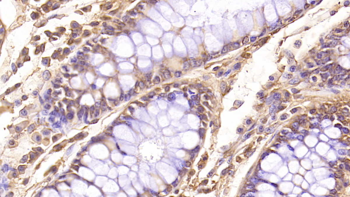 Monoclonal Antibody to Follistatin Like Protein 1 (FSTL1)