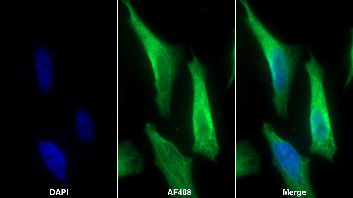 Monoclonal Antibody to Coxsackie Virus And Adenovirus Receptor (CXADR)