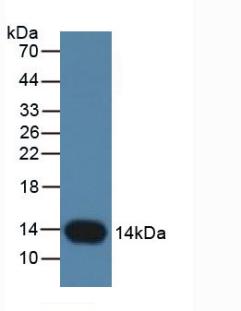 Monoclonal Antibody to Cystatin B (CSTB)