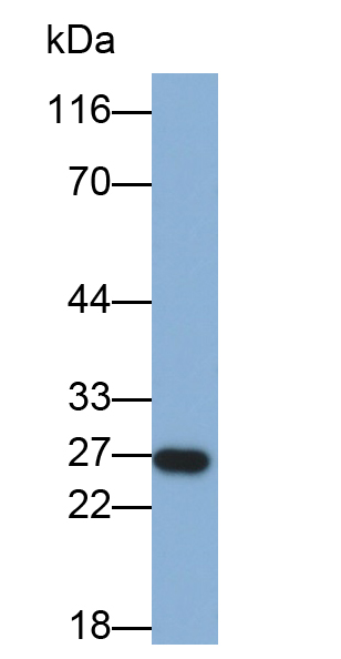 Monoclonal Antibody to Casein Beta (CSN2)