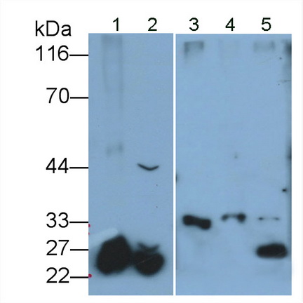 Monoclonal Antibody to Catechol-O-Methyltransferase (COMT)