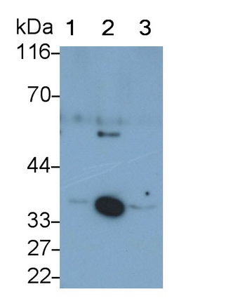 Monoclonal Antibody to Catechol-O-Methyltransferase (COMT)