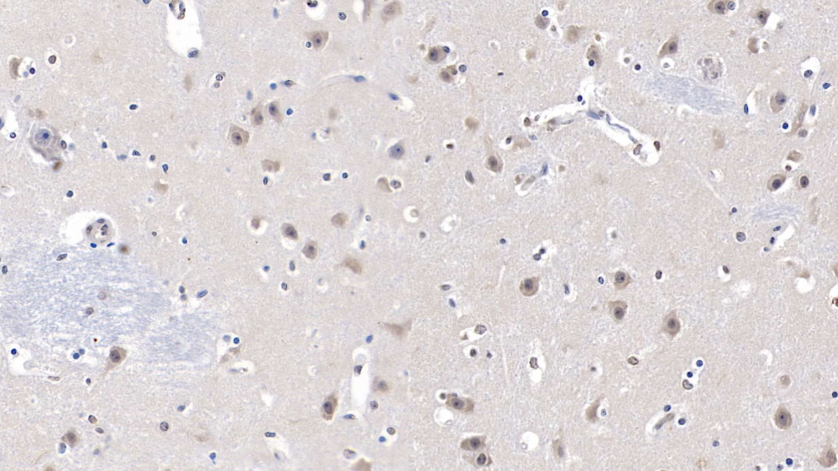 Monoclonal Antibody to Lecithin Cholesterol Acyltransferase (LCAT)