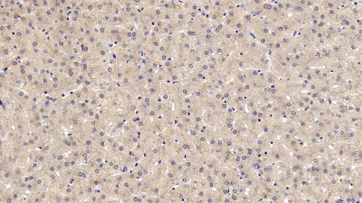 Monoclonal Antibody to Lecithin Cholesterol Acyltransferase (LCAT)