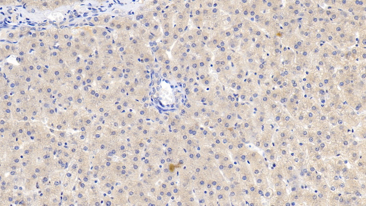 Monoclonal Antibody to Lecithin Cholesterol Acyltransferase (LCAT)