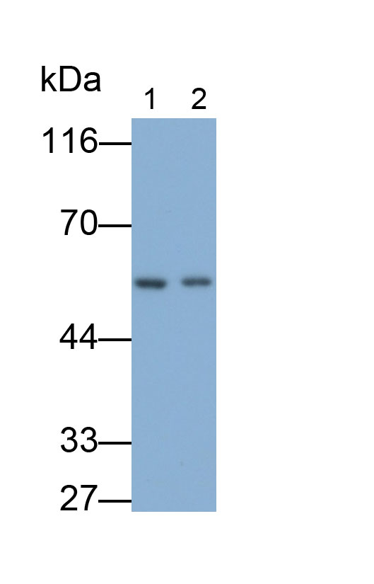 Monoclonal Antibody to Lecithin Cholesterol Acyltransferase (LCAT)