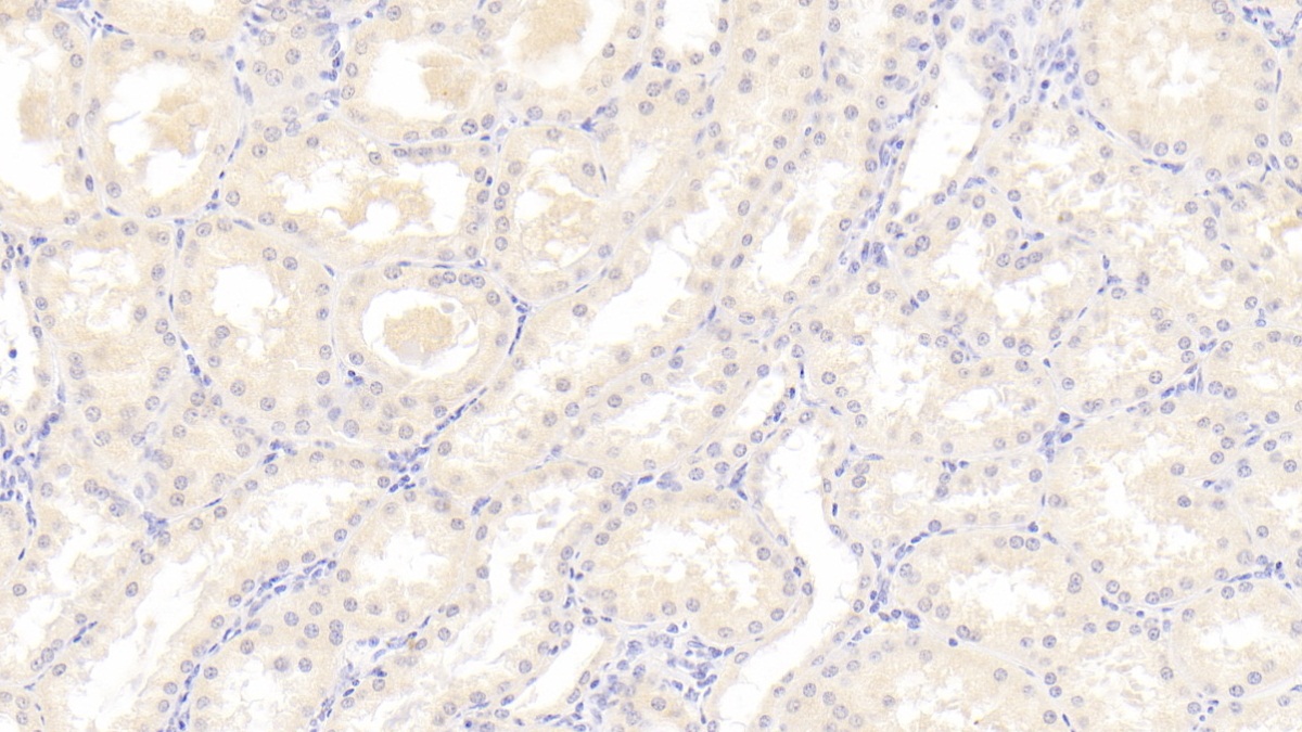 Monoclonal Antibody to Beclin 1 (BECN1)