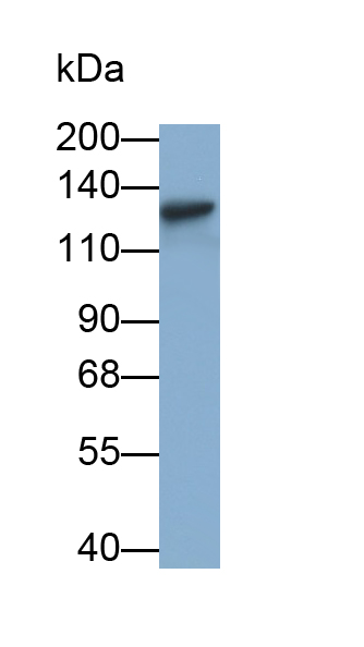 Monoclonal Antibody to Activity Dependent Neuroprotector Protein (ADNP)