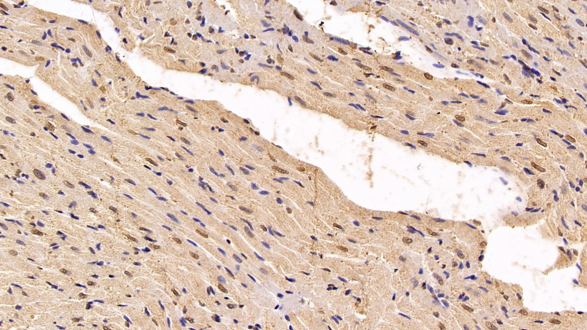 Monoclonal Antibody to Von Hippel Lindau Tumor Suppressor (vHL)