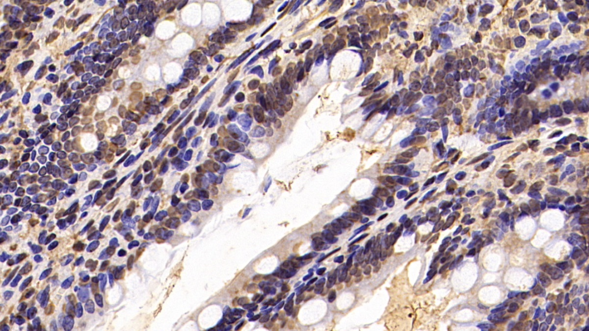 Monoclonal Antibody to Von Hippel Lindau Tumor Suppressor (vHL)