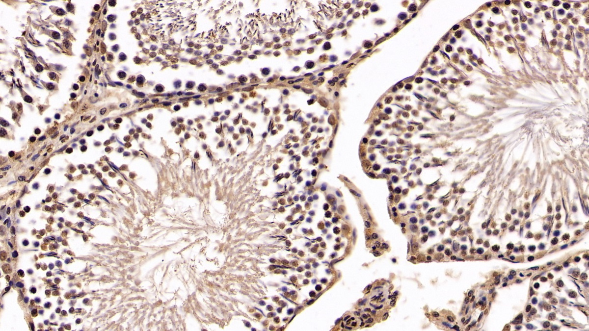 Monoclonal Antibody to Von Hippel Lindau Tumor Suppressor (vHL)