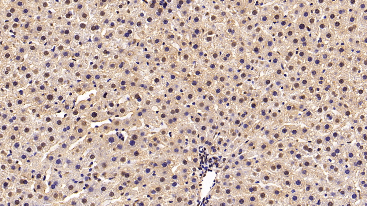 Monoclonal Antibody to Von Hippel Lindau Tumor Suppressor (vHL)