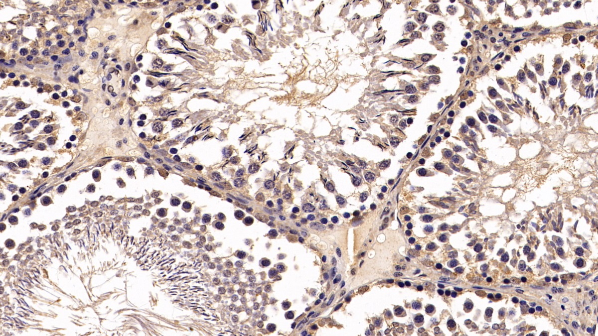 Monoclonal Antibody to Von Hippel Lindau Tumor Suppressor (vHL)