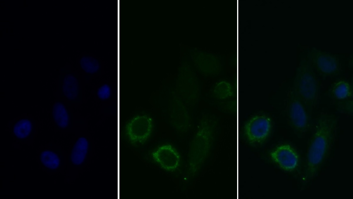 Monoclonal Antibody to Succinate Dehydrogenase Complex Subunit A (SDHA)