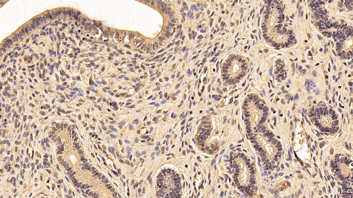 Monoclonal Antibody to Tyrosine 3/Tryptophan 5 Monooxygenase Activation Protein Zeta (YWHAz)