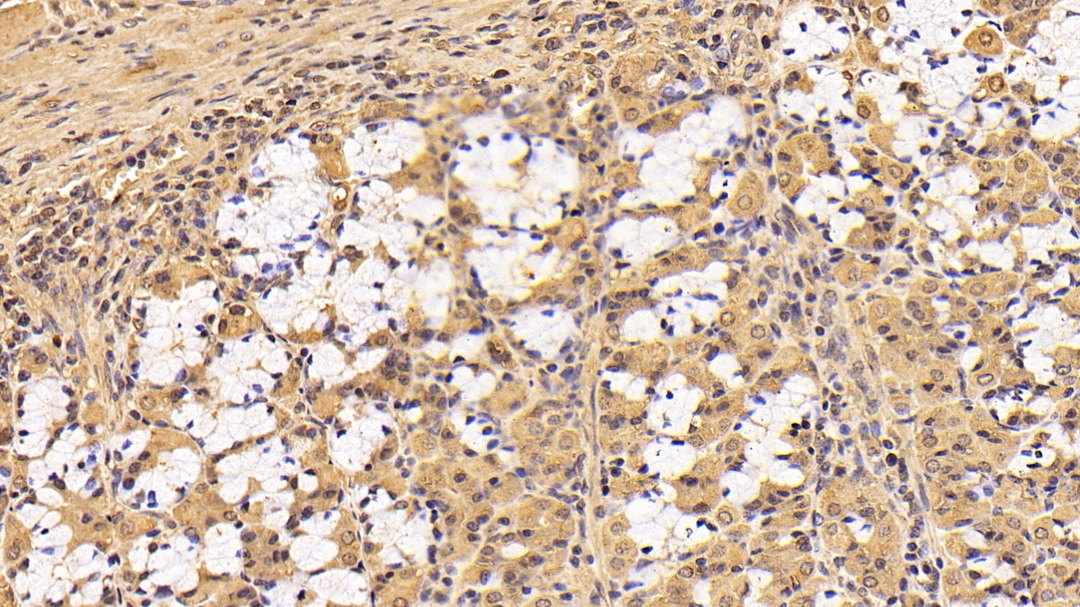 Monoclonal Antibody to Tyrosine 3/Tryptophan 5 Monooxygenase Activation Protein Zeta (YWHAz)