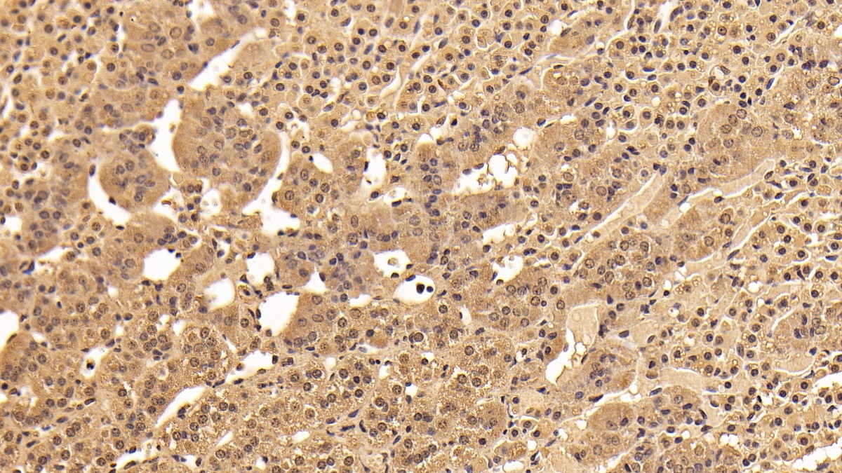 Monoclonal Antibody to Tyrosine 3/Tryptophan 5 Monooxygenase Activation Protein Zeta (YWHAz)