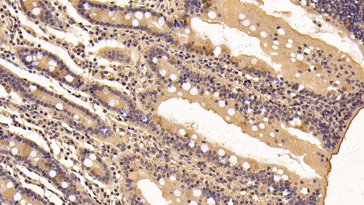 Monoclonal Antibody to Tyrosine 3/Tryptophan 5 Monooxygenase Activation Protein Zeta (YWHAz)