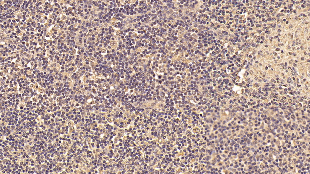 Monoclonal Antibody to Tyrosine 3/Tryptophan 5 Monooxygenase Activation Protein Zeta (YWHAz)