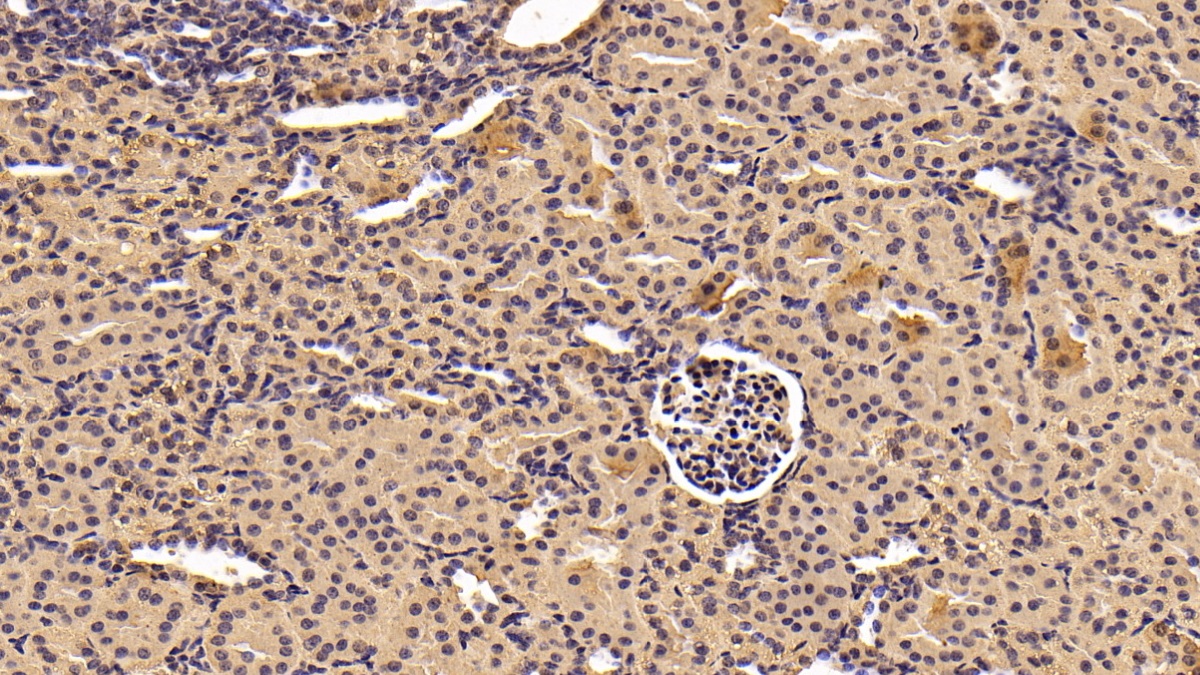 Monoclonal Antibody to Tyrosine 3/Tryptophan 5 Monooxygenase Activation Protein Zeta (YWHAz)